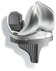 A total knee implant by Mako